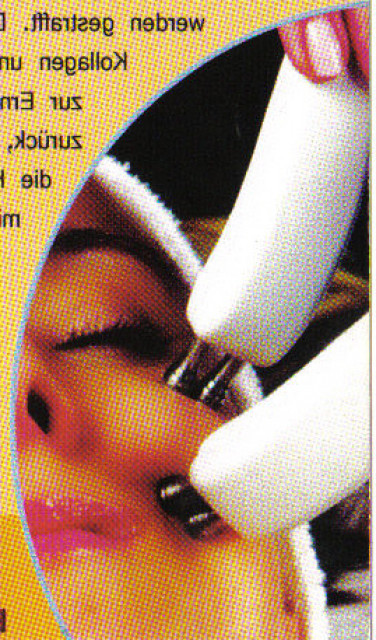 BIO-Lifting - Sensationell & Einzigartig - Face-Lift ohne Skalpell - Wellness Gesundheit - Ehningen