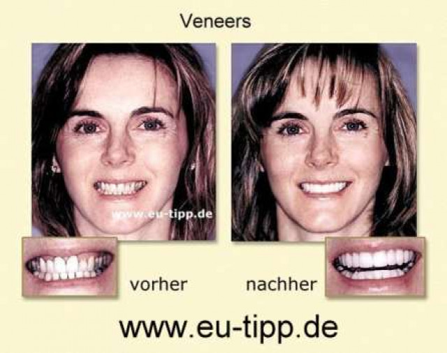 Zahnbehandlung in CZ - Implantate ab € 490 - Wellness Gesundheit - Pardubice