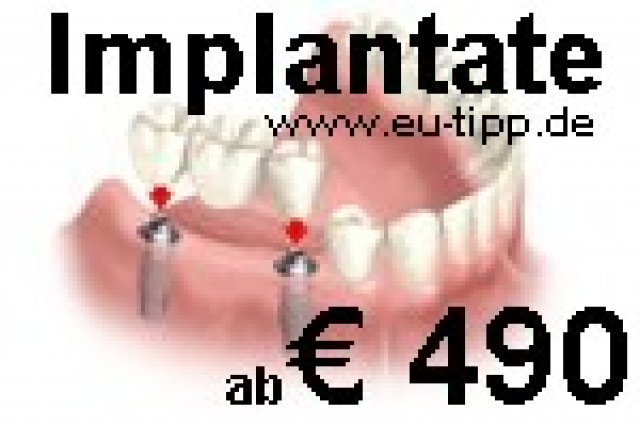 ZAHN-Behandlung CZ -günstiger als Ungarn/Polen- Implantate € 490 - Wellness Gesundheit - Pardubice